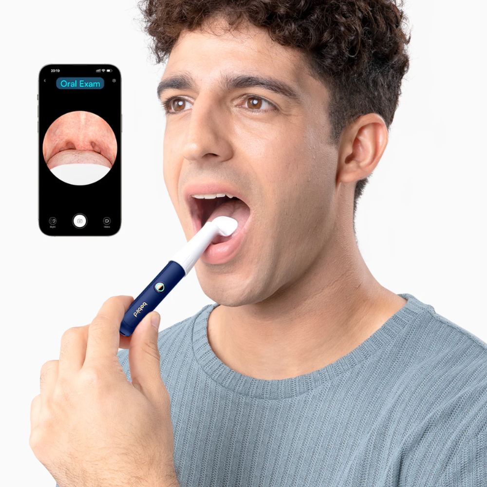 Bebird oral examination tool with flexible curved tip and real-time mouth cavity view